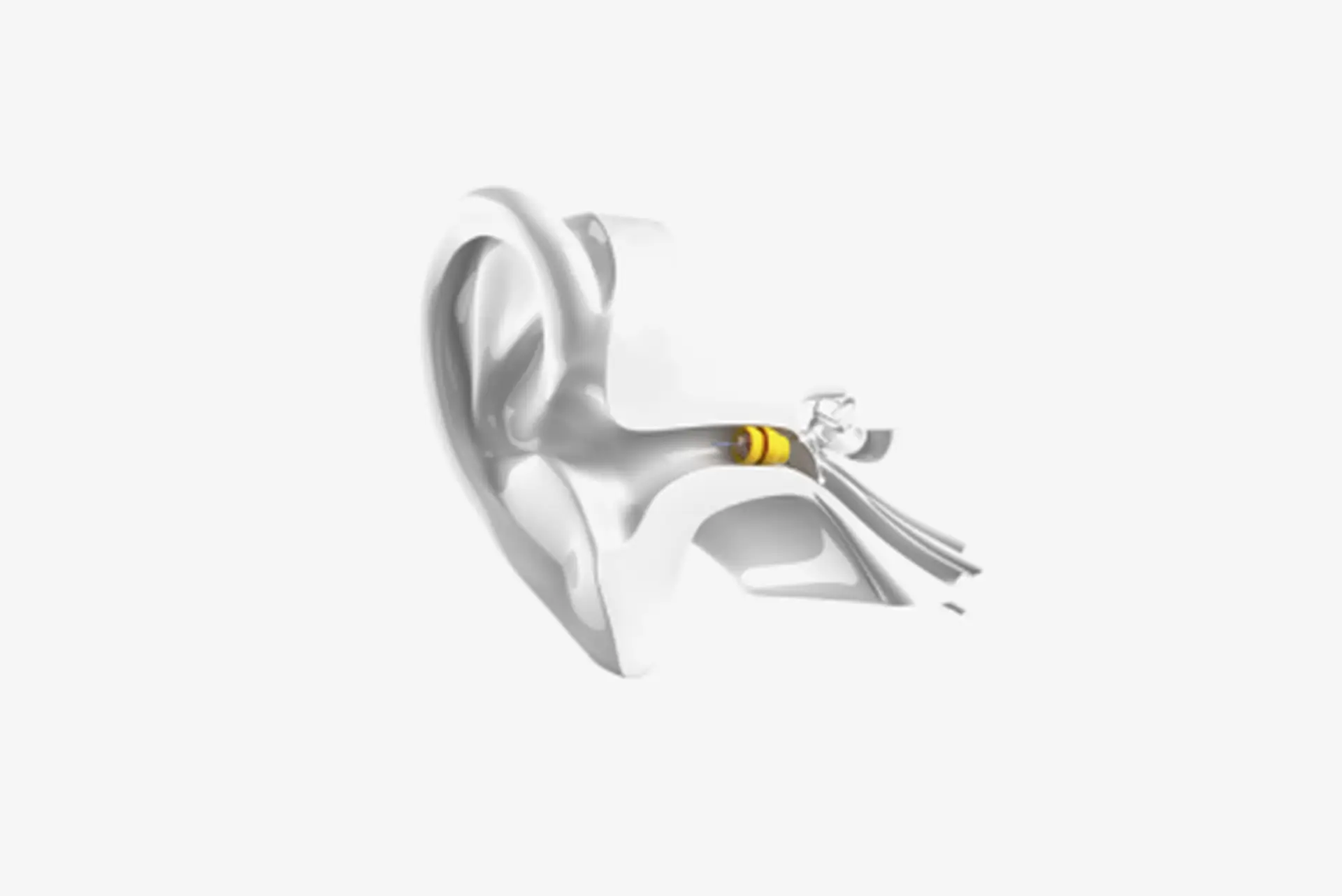 Completely Invisible Lyric Hearing Aid Image
