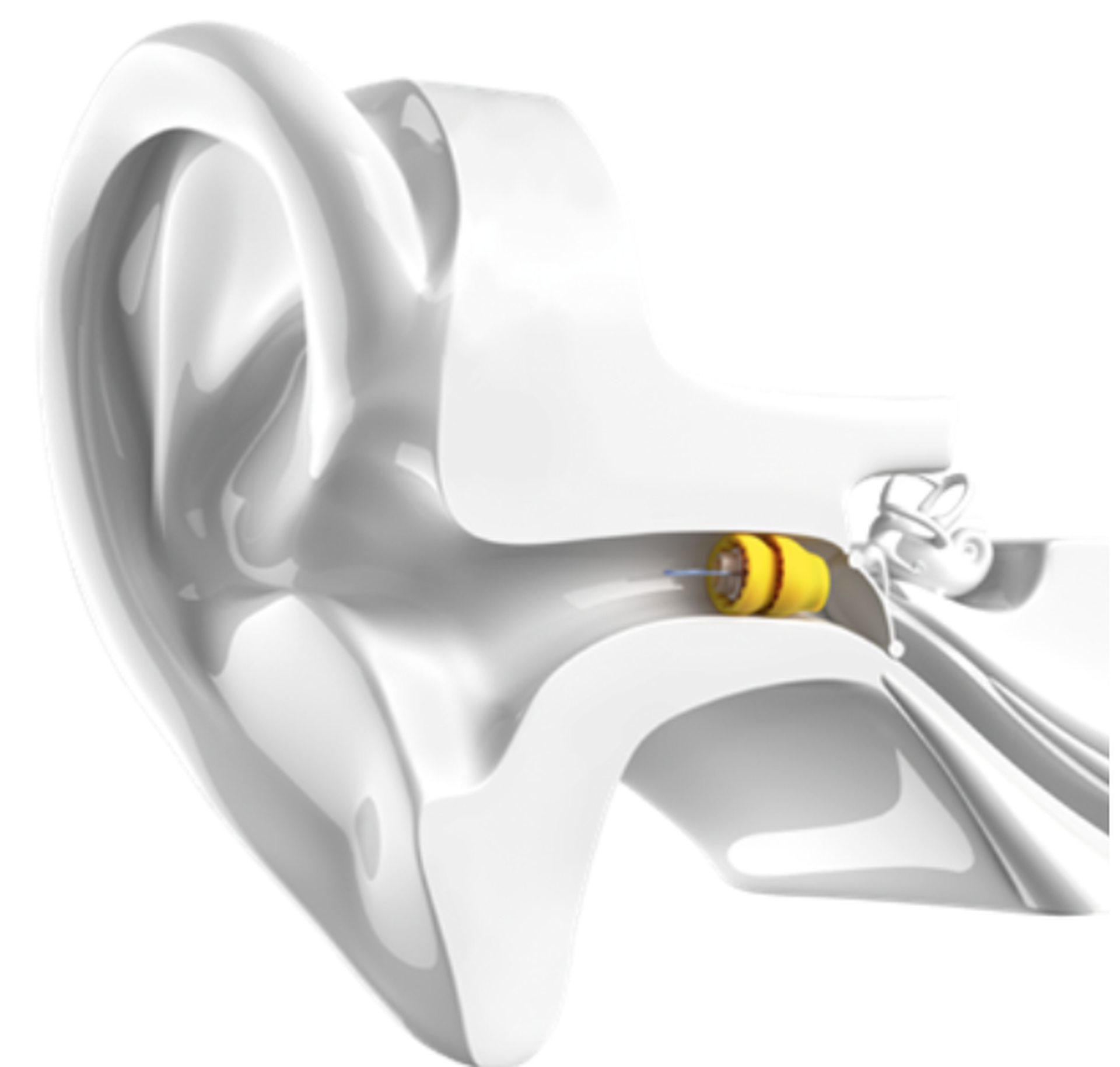 Beacon Audiology Hearing Tests Hearing Aids Balance Tests